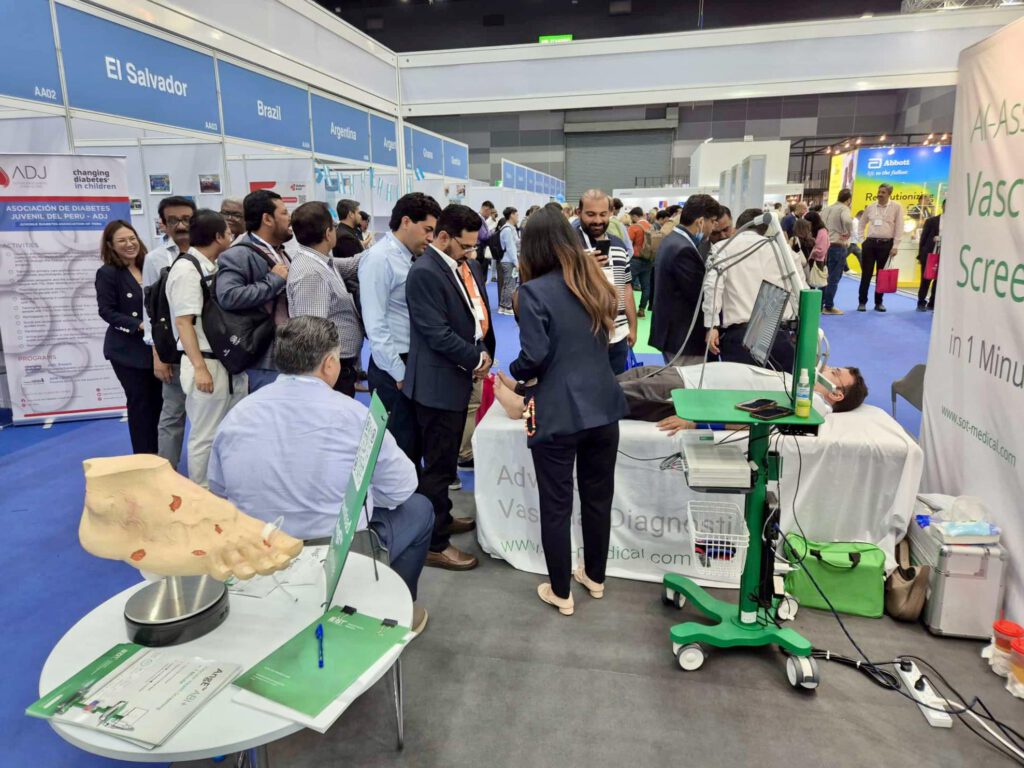 Visitors line up at the SOT Medical Systems booth at IDF 2025 in Bangkok to undergo a quick vascular screening. In the foreground, a model of a diabetic foot is displayed, while a vascular check using the AngE™ system is performed on the right.
