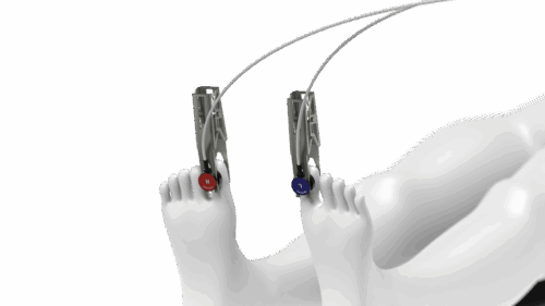 Finger/Zehen-Clip – Bild 6