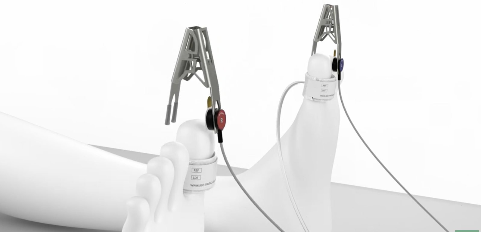 How to Measure Toe Pressure and TBI: A Step-by-Step Guide for Reliable Vascular Assessment