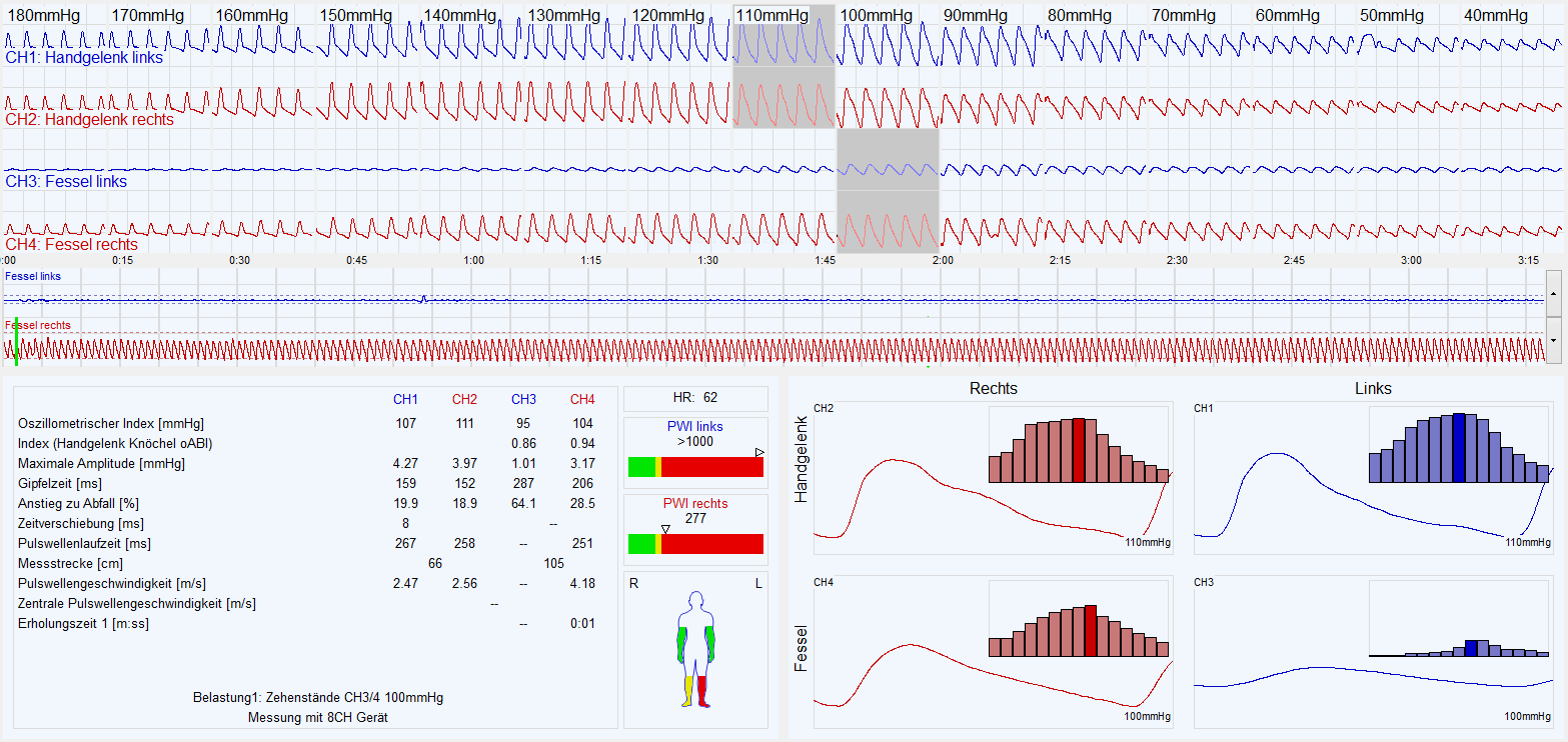 AngE PHLEBOLOGIC - SOT Medical Systems